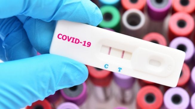 ilustrasi rapid test virus corona covid-19 (jogja.suara.com)